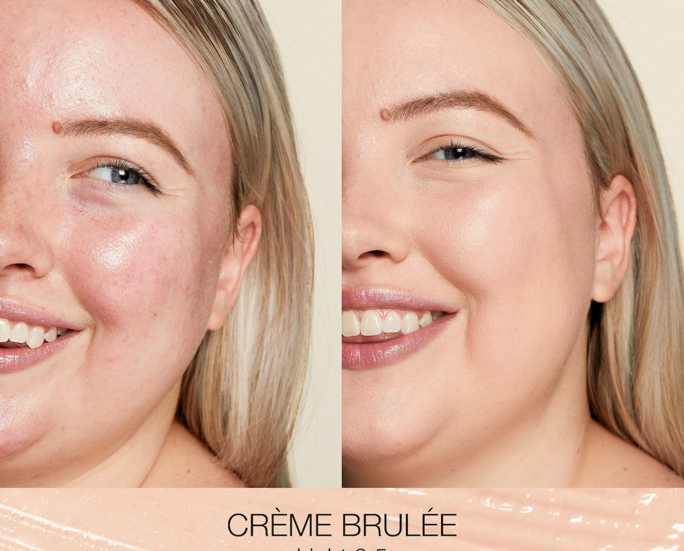a model&#x27;s before photo showing redness and an after photo wearing the concealer and redness covered.