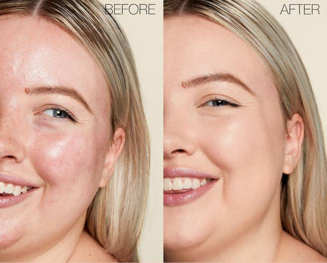 a model's before photo showing redness and an after photo wearing the concealer and redness covered.