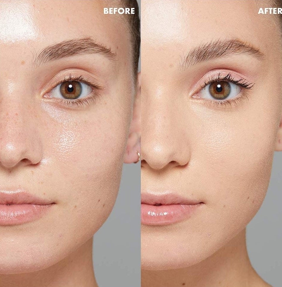 A person&#x27;s face before and after using the primer, it is significantly more matte and poreless looking in the after photo