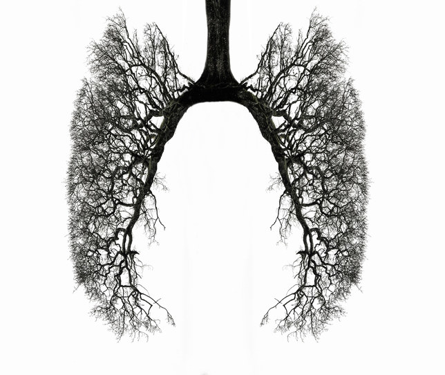 Winter tree branches in the shape of human lungs