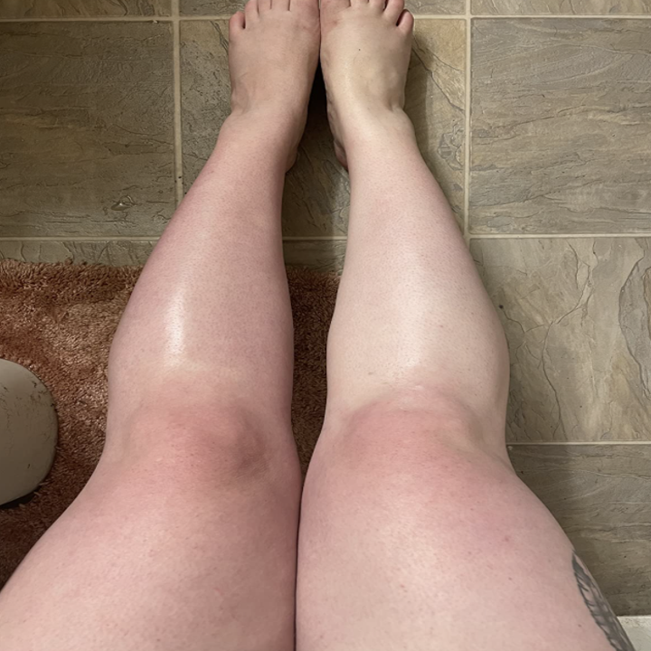 reviewer legs after using exfoliating mitt