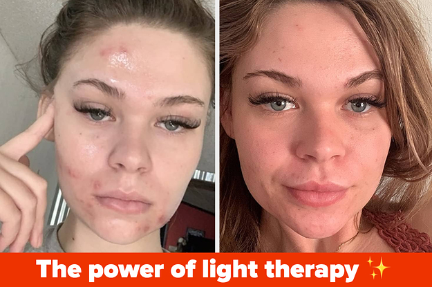 I'm an image I'm an image