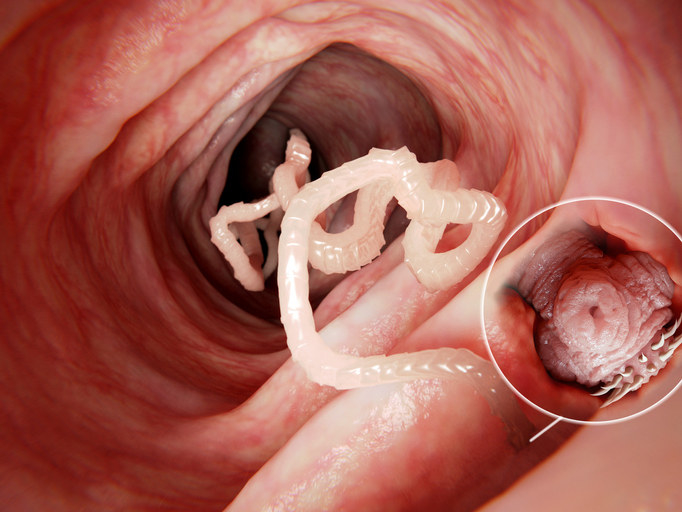 Tapeworms inside a body
