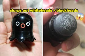 L: blackhead and whitehead remover shaped like a black octopus R: closeup of the remover showing the whiteheads it removed from someone's face
