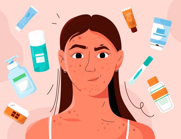 illustration of a woman with acne, the illustration also features many skincare product bottles around her