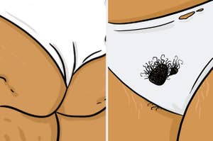 Illustration of a wedgie and pubic hair sticking out of underwear