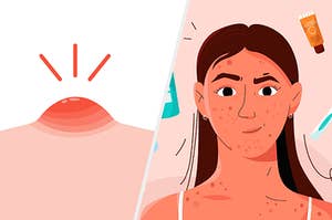 split illustration on the left of a pimple and on the right is an illustration of a woman smirking with products around her