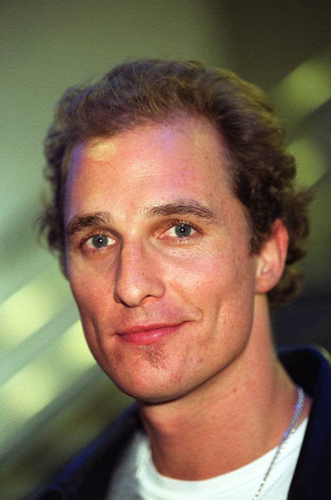 in a picture from 1999, his hair appears thick and curly, but upon closer inspection, you can tell it&#x27;s thinning at the sides, and his hairline is receding