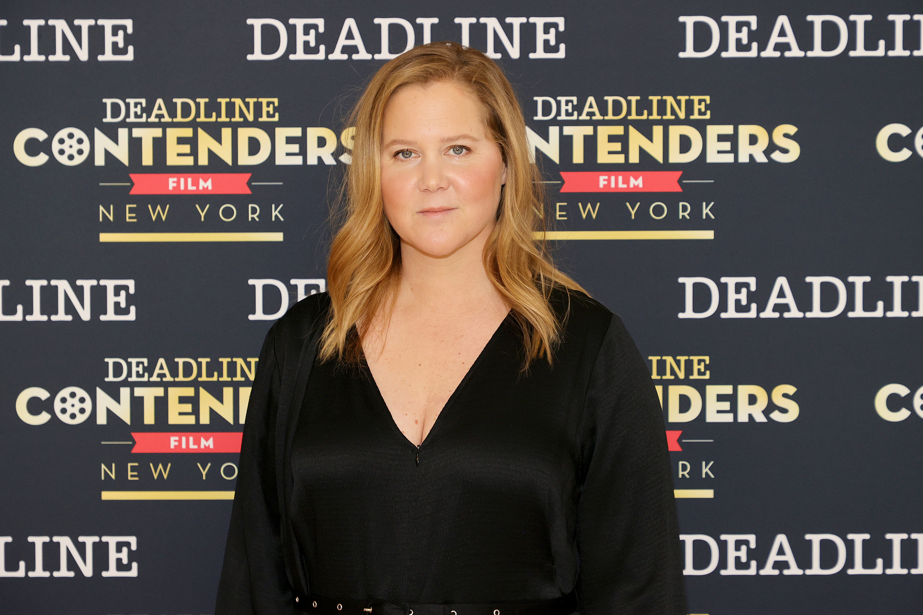 3000px x 2000px - Amy Schumer Opened Up About Getting Liposuction