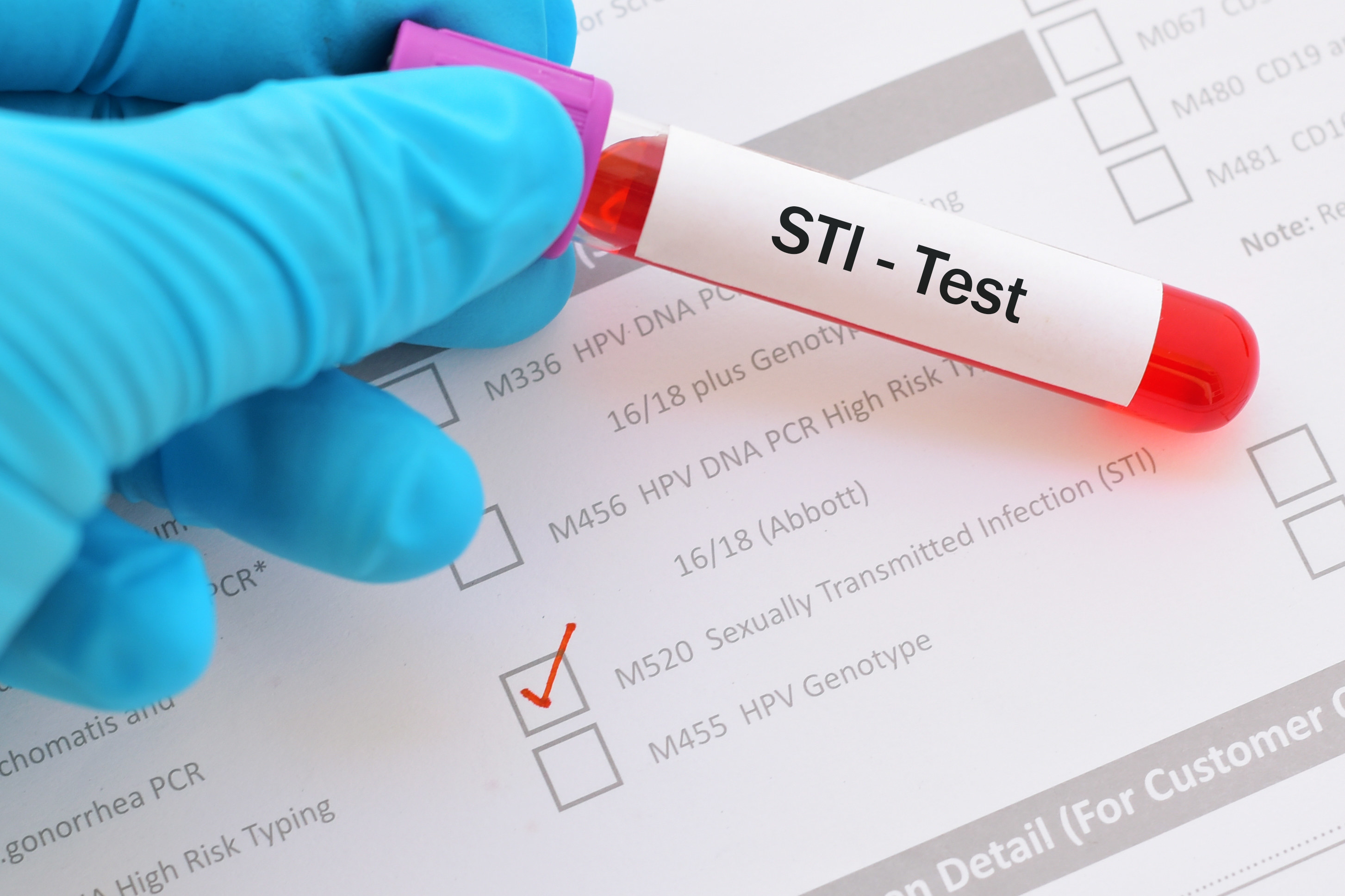 a gloved hand holding a tube of blood labeled &quot;STI Test&quot;