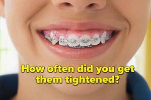 A woman is flashing her braces labeled, "How often did you get them tightened?"