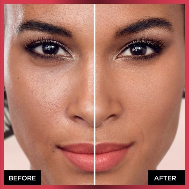 Model with a before and after photo while using the product