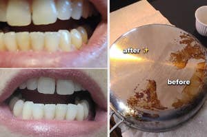 teeth whitening and pan cleaner