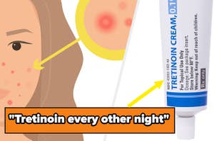 split image of an illustration of acne while on the left is a acne product 