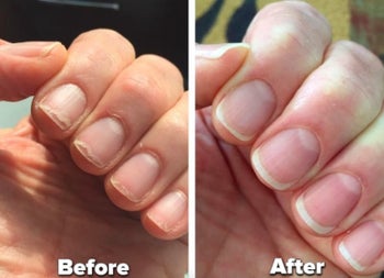reviewer before and after pic showing their nails brittle and breaking before and strong after using the oil
