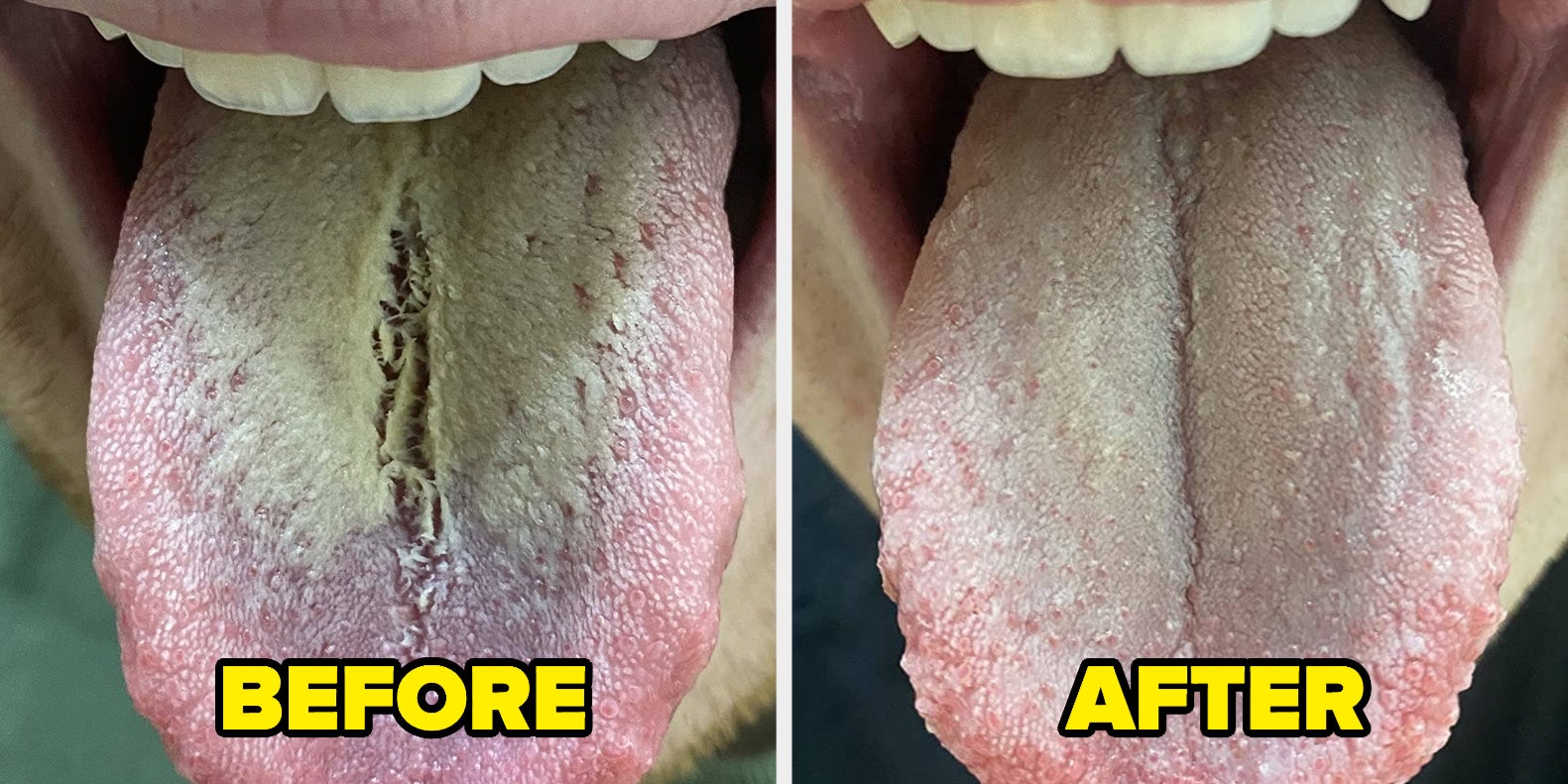 41 Products With Before And After Pics To Prove You'll Get Your Money's Worth - Vimarsana News