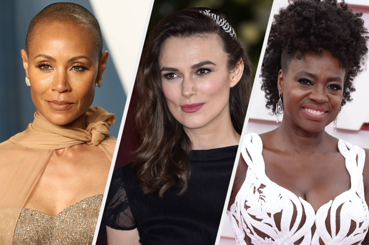 Female celebs who are balding