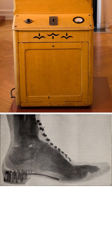 A shoe-fitting fluoroscope machine above the X-ray image of a foot in a shoe