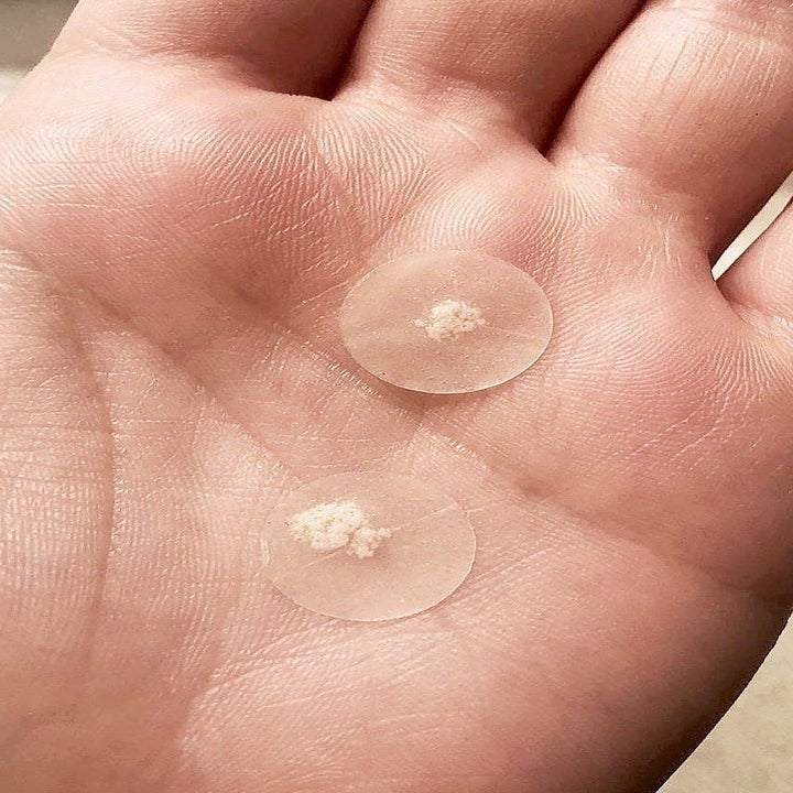 A person holding two patches filled with gunk