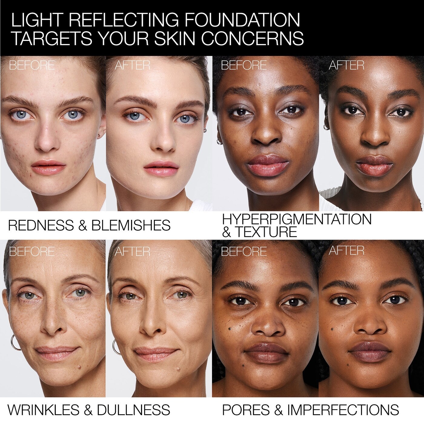 Models of different skintones with before and after photos