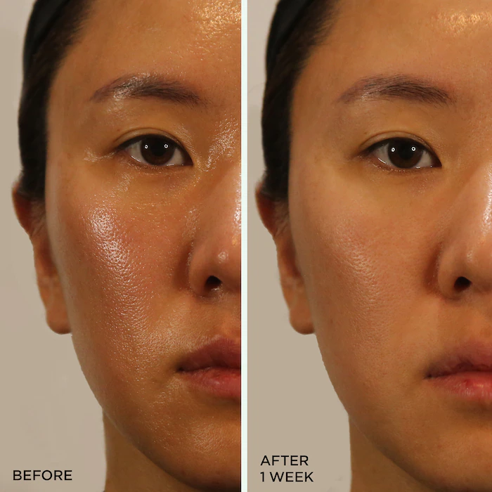 A before image of a person with textured skin and after image of it looking much smoother