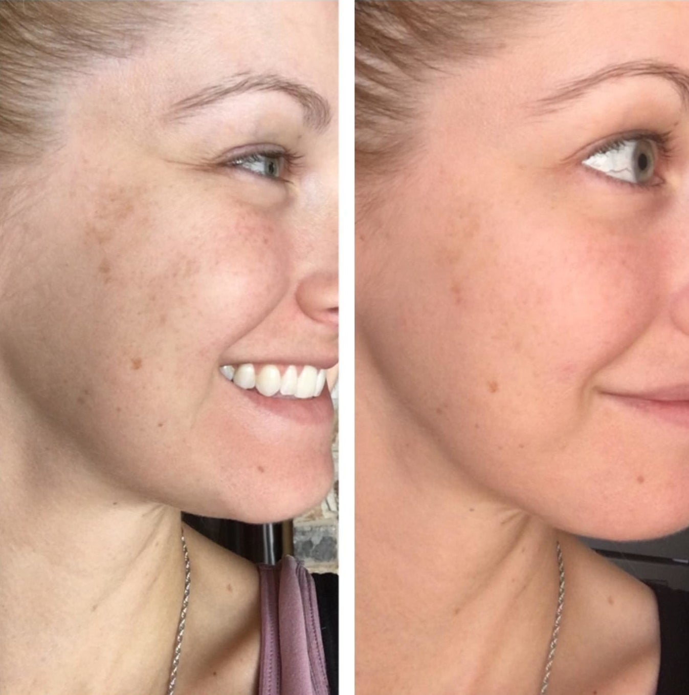 a reviewer before and after with the serum