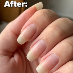 A before and after of using the cuticle remover