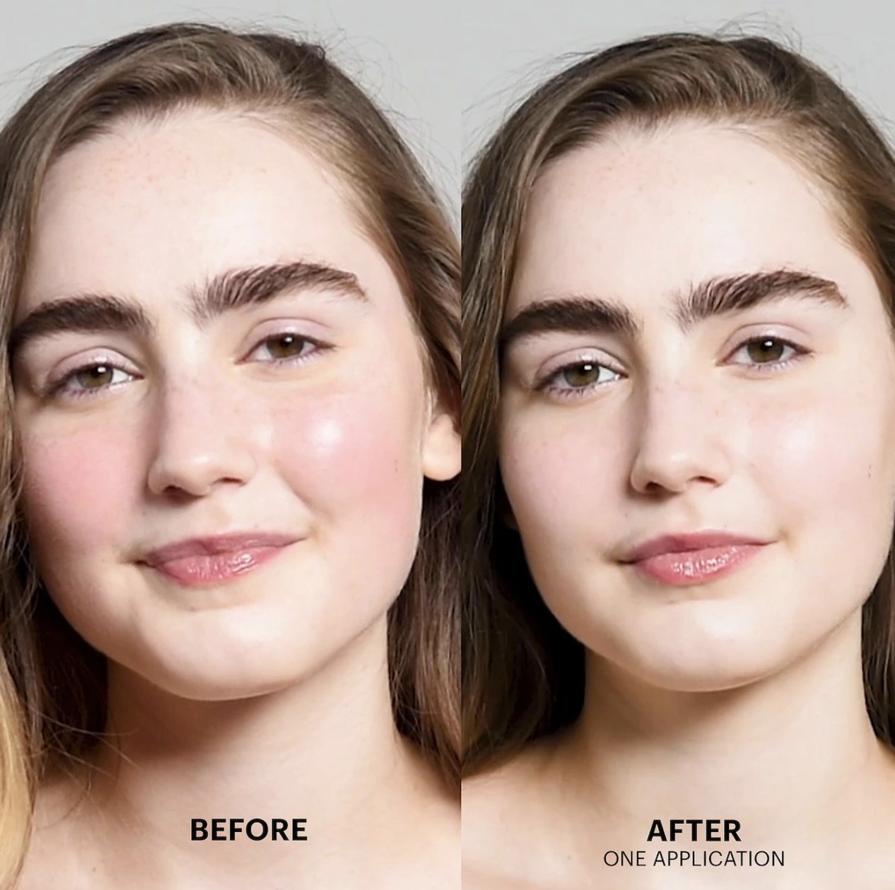 before and after showing model with red skin before and clear, even skin without redness after one application of the cream