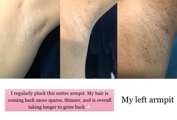 Reviewer showing results of using Tree Hut Bare Hair Minimizing Body Butter