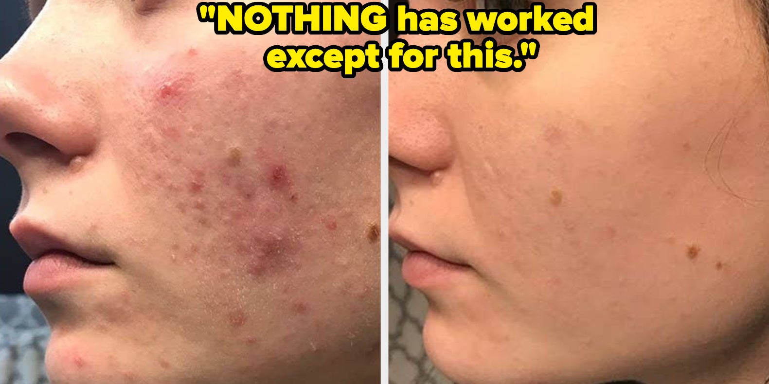 35 Products So Great You'll Keep Repurchasing Them - Vimarsana News