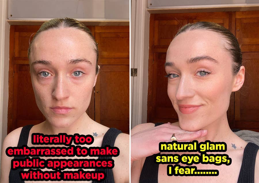 Reviewers 'Can't Believe' How Quickly This Eye Gel Tones Down Bags