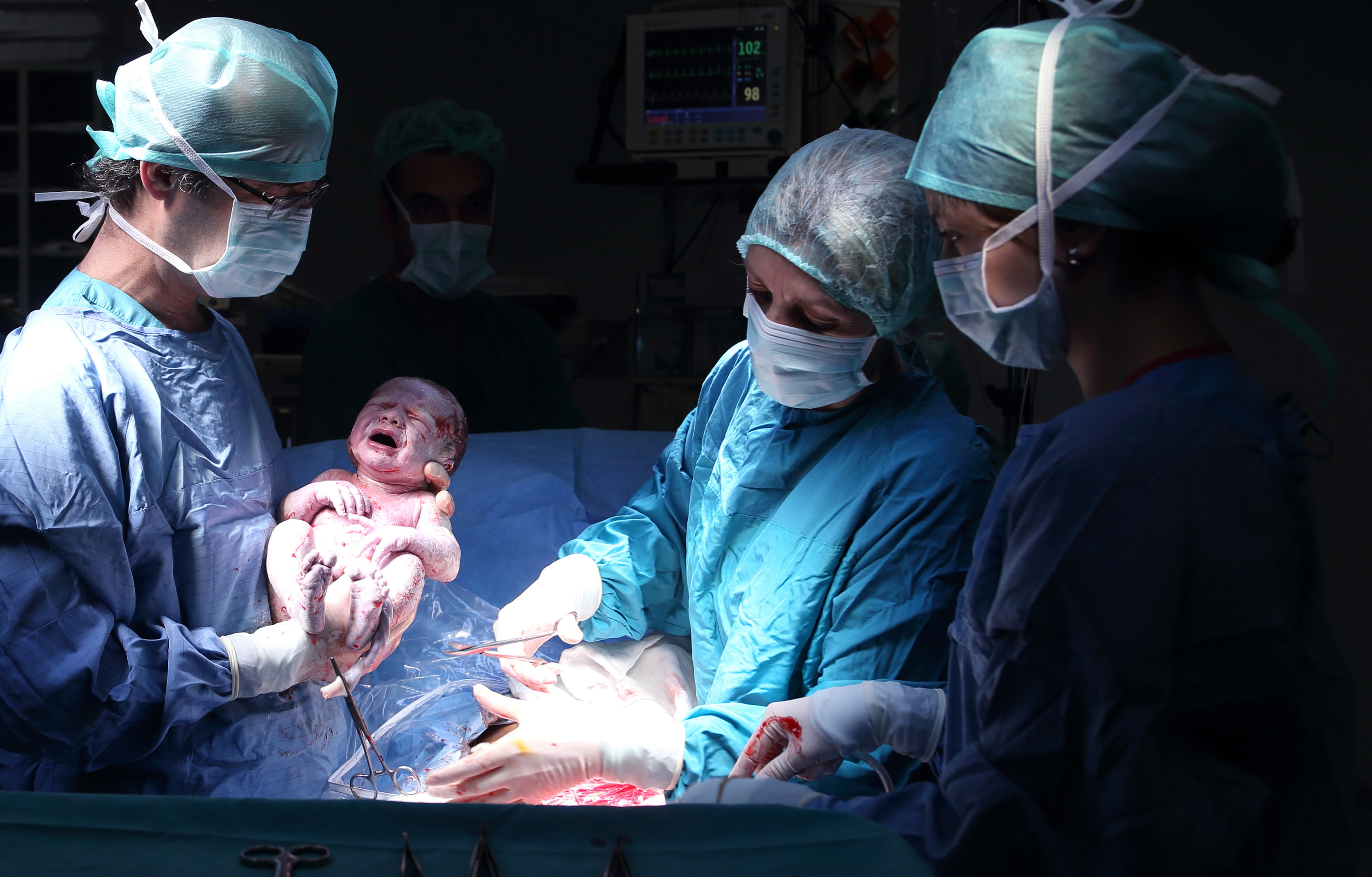 A newborn baby being held by a doctor and surgeons operating