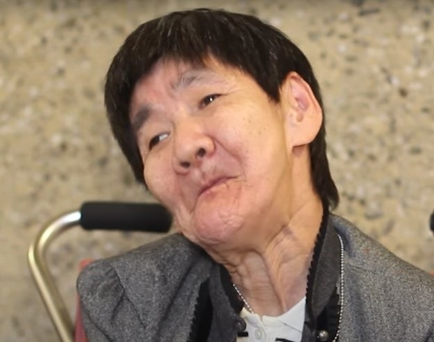 Minamata disease survivor Shinobu Sakamoto speaks about her experiences