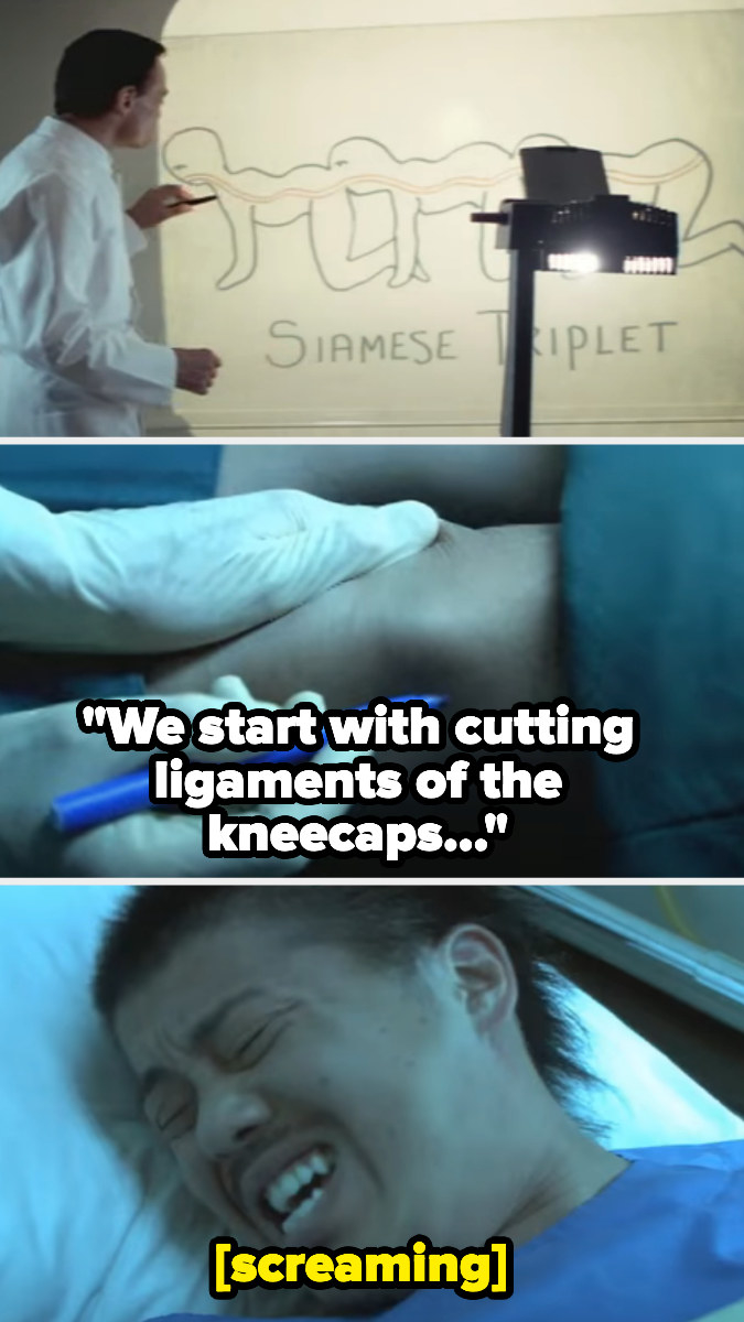 A doctor drawing a &quot;Siamese triplet&quot; and a person screaming in a hospital bed