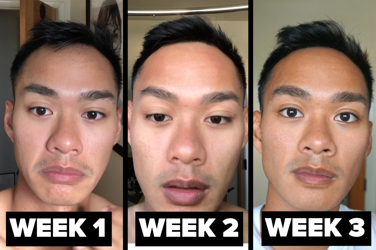the progression from week one to week 3 showing better skin results
