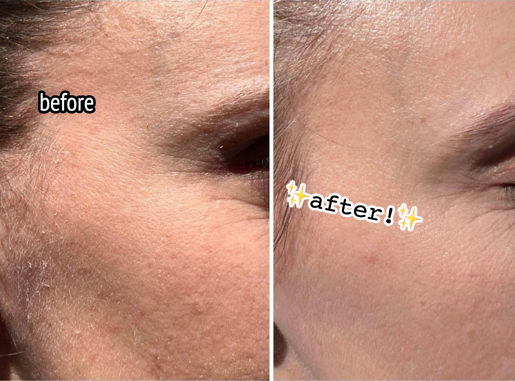 A person&#x27;s skin texture before and after using the product