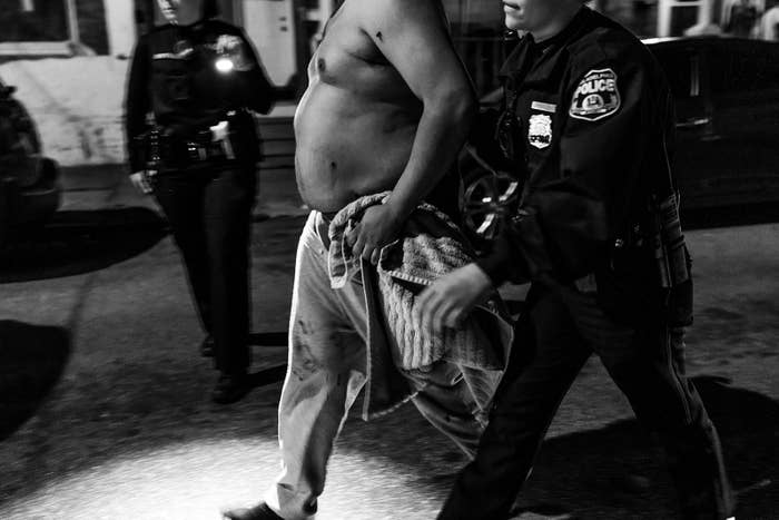 police escort a man with no shirt on, and visible bullet wounds