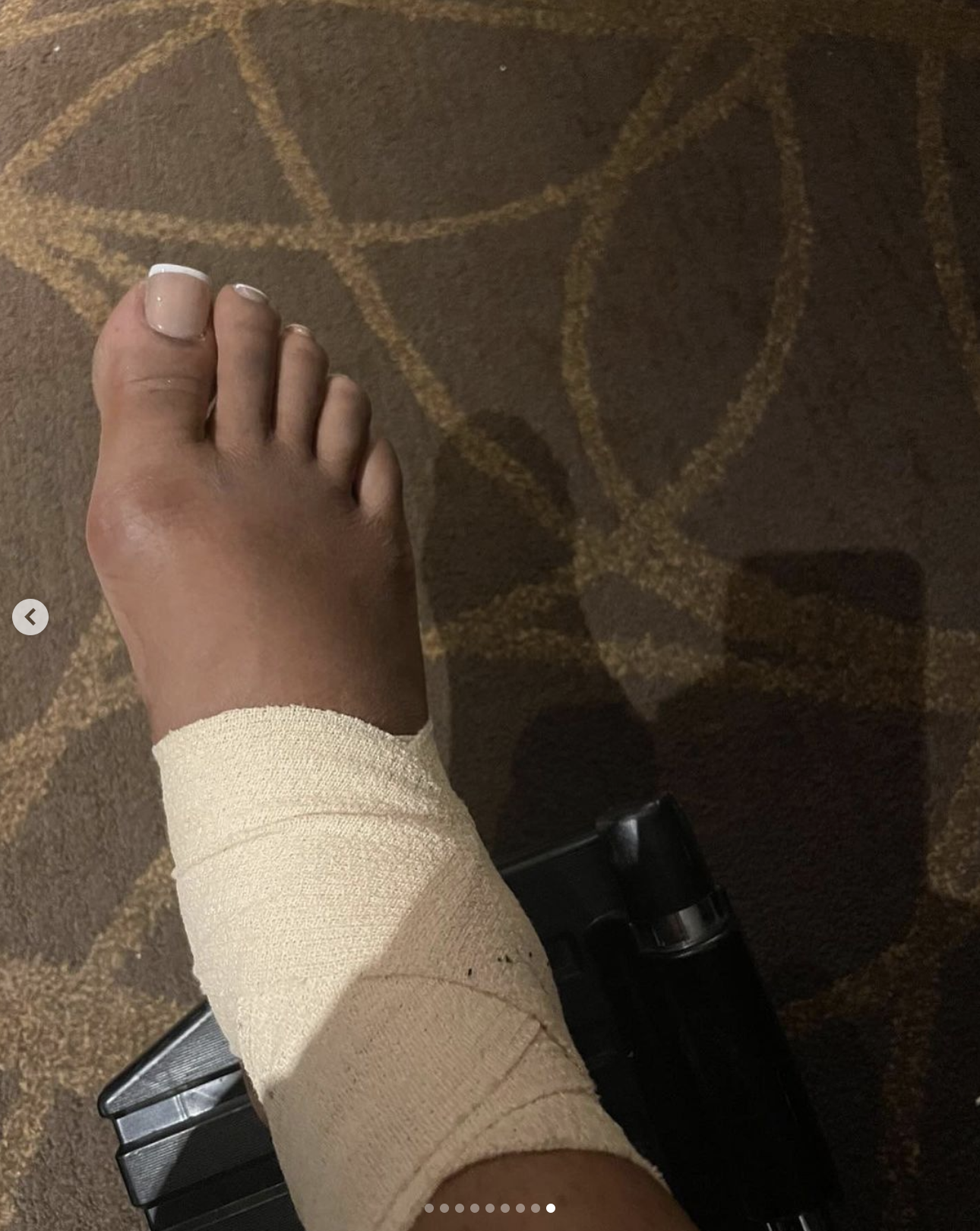 SZA&#x27;s ankle wrapped up after an injury.