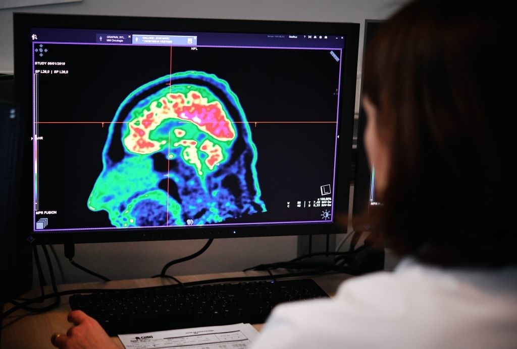 A woman looking at a brain scan
