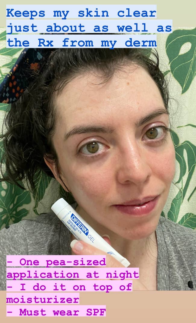 Reviewer's no-makeup face with no acne in sight, she holds a small tube of the product