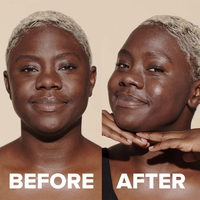 A before image of a person without sunscreen on their face, An after image of their skin looking more hydrated.