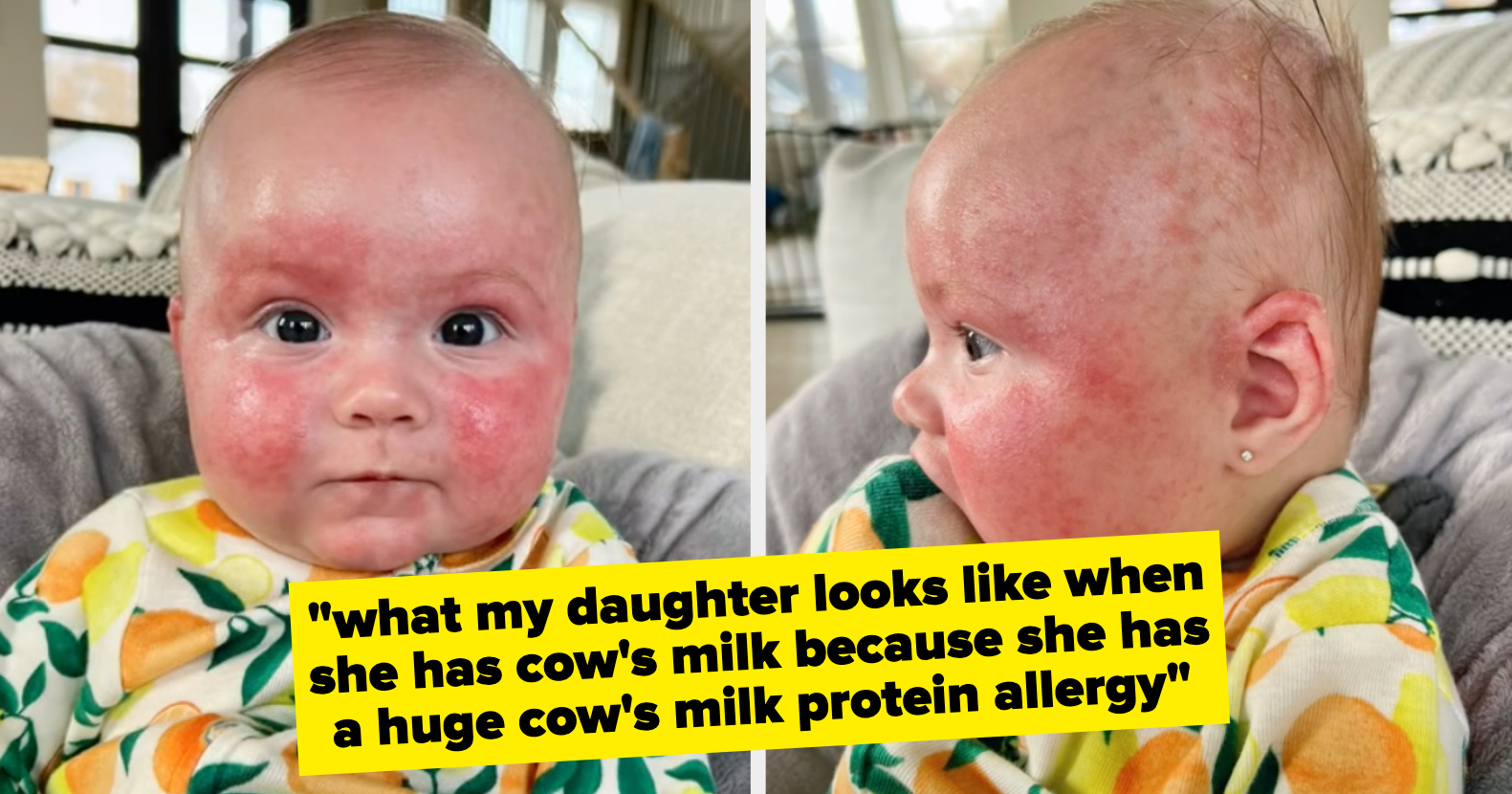 This Mom Shared How The Formula Shortage Is Affecting Her Baby, And It’s An Awful Reality Parents Are Facing Right Now