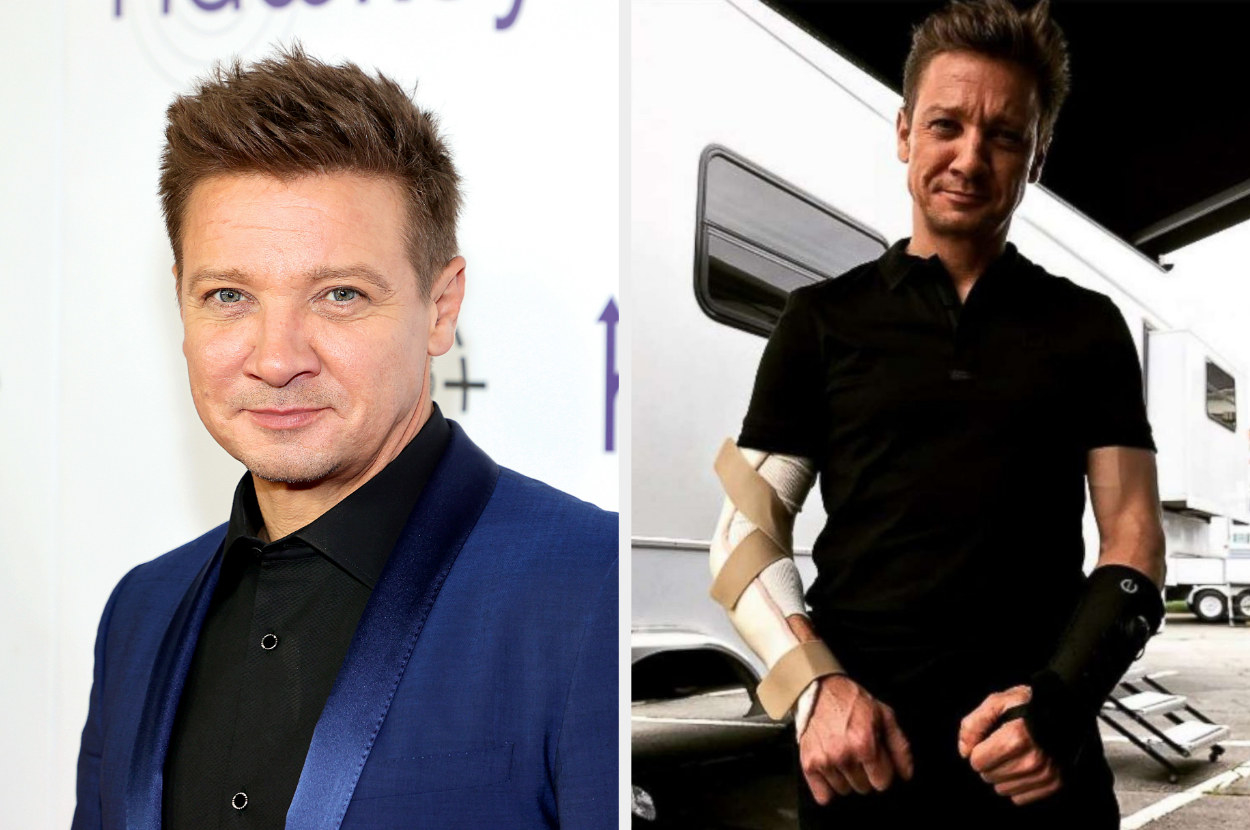 Renner with his broken arms on set