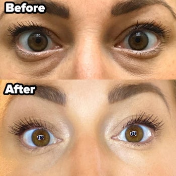 reviewer before and after of their dark under-eyes and then brightened under-eyes using the concealer