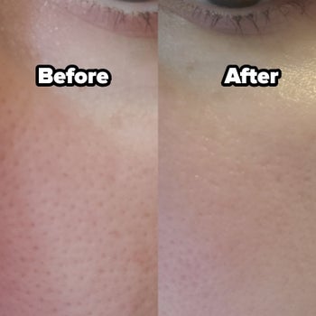 reviewer before and after close-up of pores on their face without and then with the primer, looking minimized