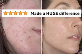 a reviewer's before and after of their skin which was red and bumpy and is now clear after using cerave