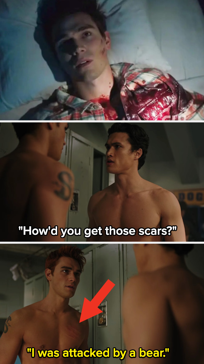 A person asking Archie how he got his scars and him telling them that he got mauled by a bear