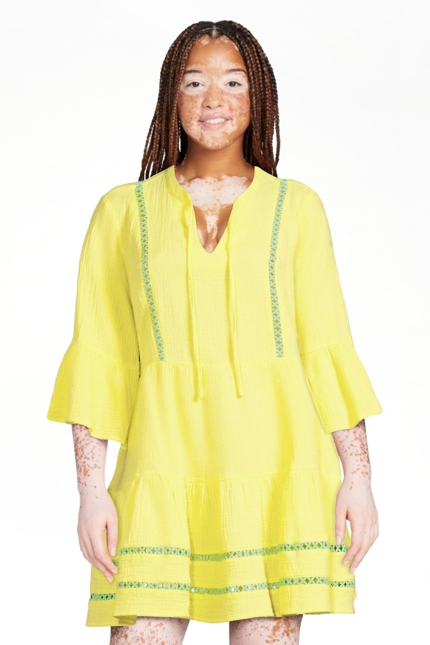 A model wearing the dress in yellow with green detailing