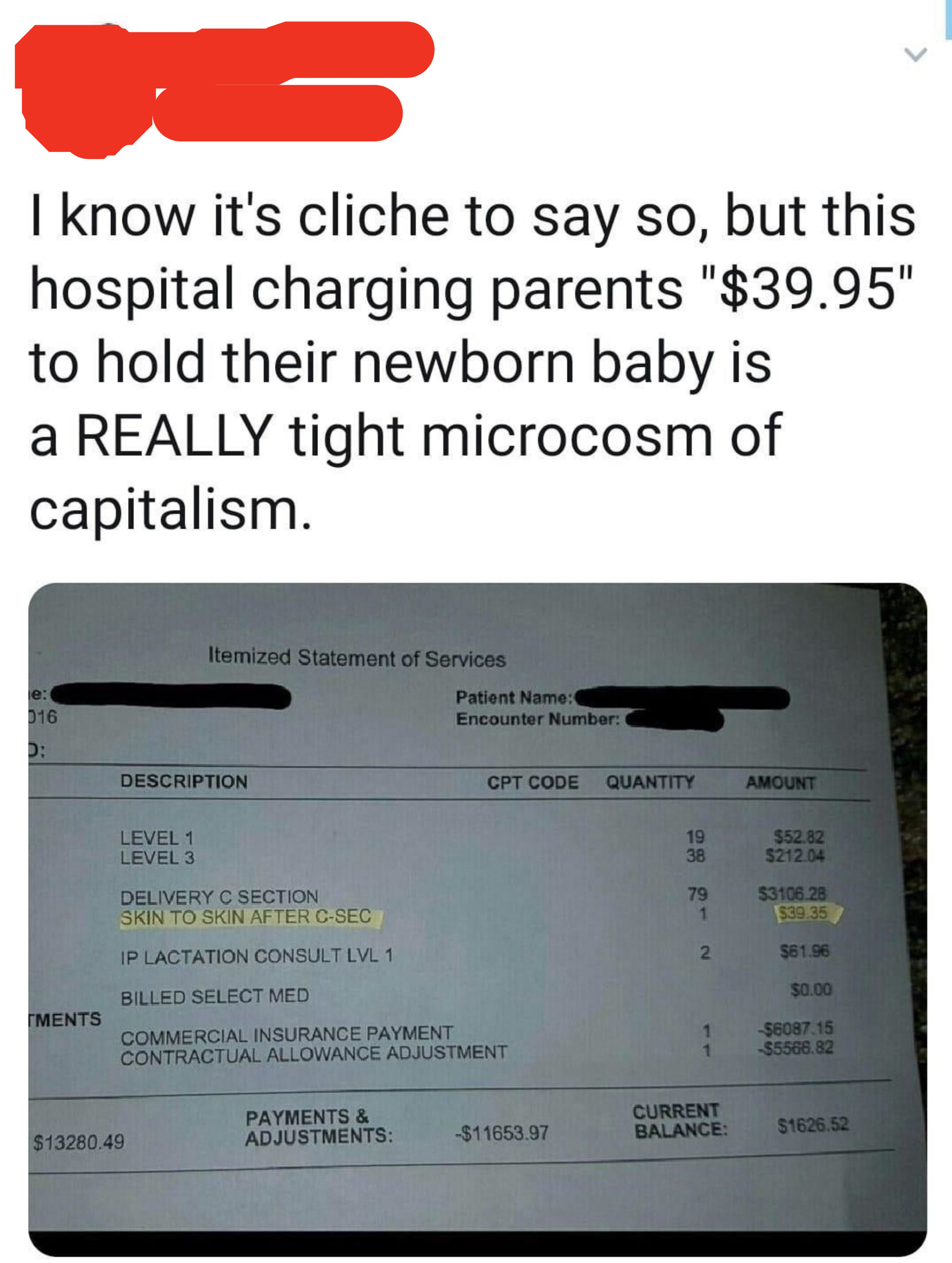 Tweet: &quot;I know it&#x27;s cliche to say so, but this hospital charging patients $39.95 to hold their newborn baby is a REALLY tight microcosm of capitalism&quot; with a bill with a $39.35 charge for &quot;Skin to skin after C-section&quot;