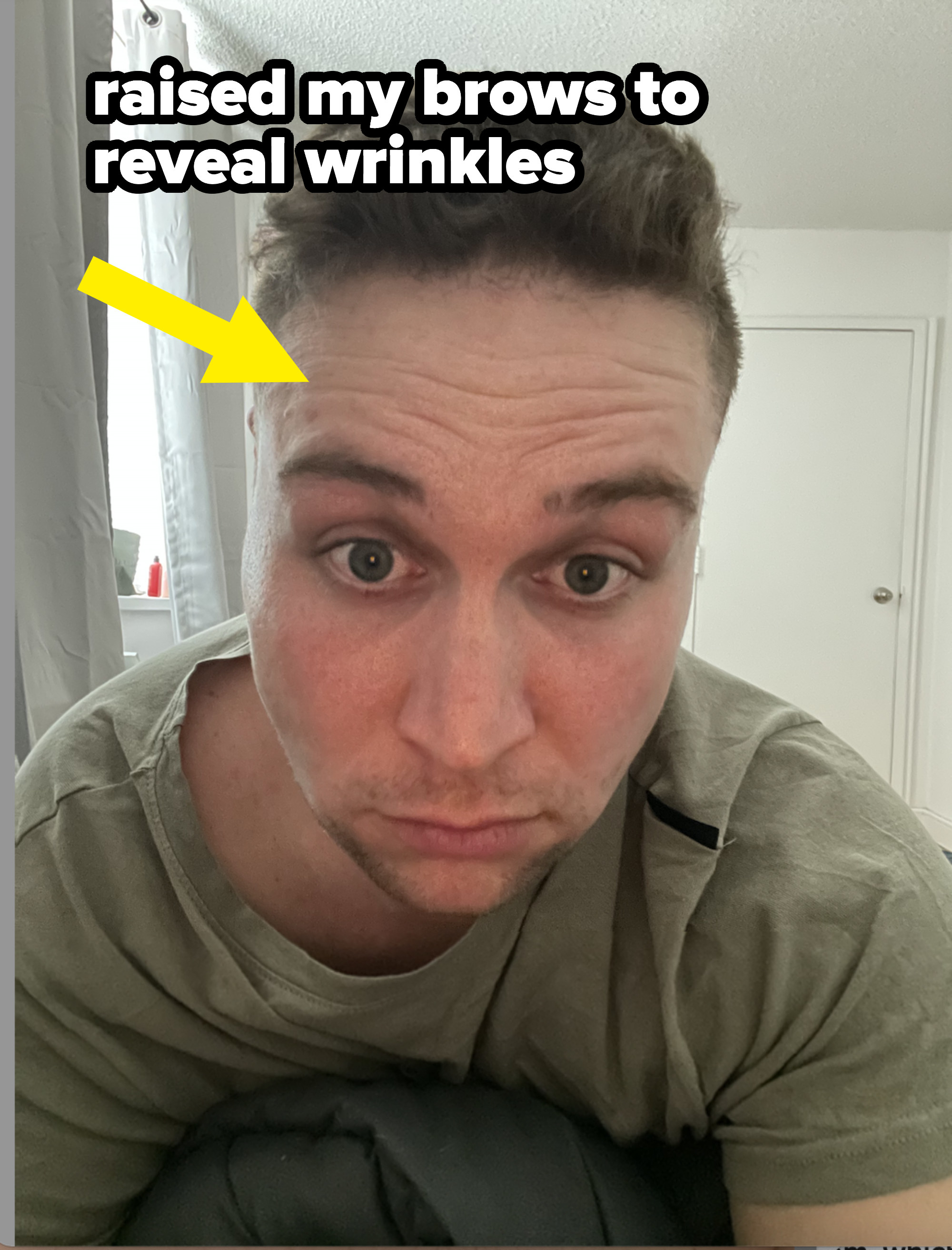 Arrow pointing to writer&#x27;s forehead wrinkles with the text &quot;Raised my brows to reveal wrinkles&quot;